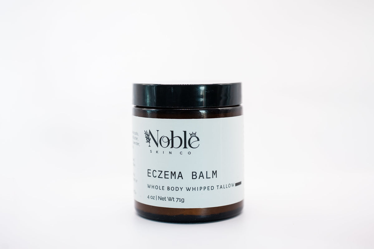 Noble Skin Co eczema balm jar for dry, irritated skin and eczema flare-ups