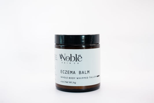 Noble Skin Co eczema balm jar for dry, irritated skin and eczema flare-ups